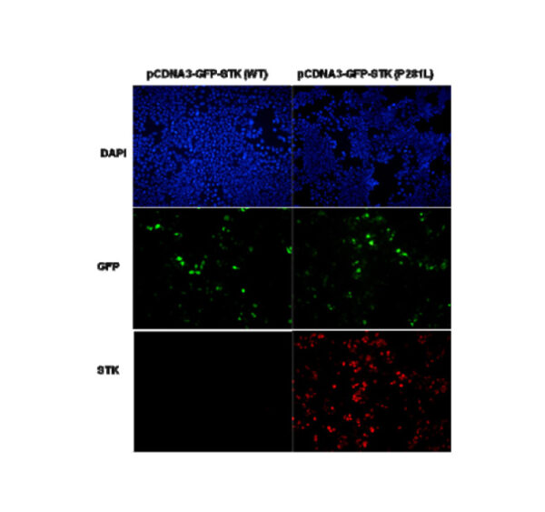 STK11 MAb NewEast Biosciences GTPase And Oncogene